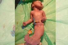 OMG! Mermaid baby, जन्माला आलं माशासारखं शरीर असलेलं बाळ OMG! Mermaid baby, जन्माला आलं माशासारखं शरीर असलेलं बाळ