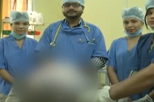 पोट दुखायचं निमित्त! 6 तासांच्या ऑपरेशननंतर महिलेच्या पोटातून निघाला फुटबॉलच्या दुप्पट आकाराचा ट्युमर