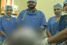 6 तासांच्या ऑपरेशननंतर महिलेच्या पोटातून निघाला फुटबॉलच्या दुप्पट आकाराचा ट्युमर 6 तासांच्या ऑपरेशननंतर महिलेच्या पोटातून निघाला फुटबॉलच्या दुप्पट आकाराचा ट्युमर