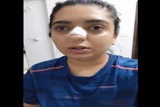 'झोमॅटो डिलिव्हरी बॉयने नाक फोडलं' रक्तबंबाळ अवस्थेत महिलेचा आरोप Viral Video