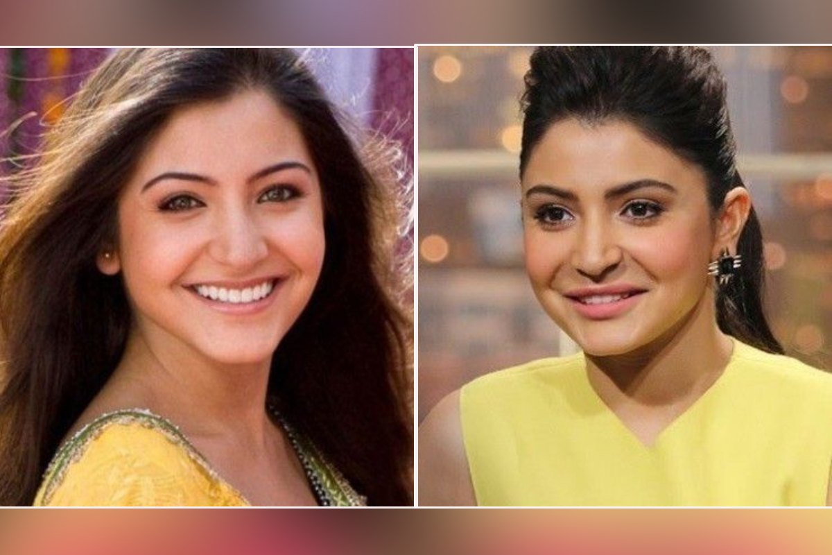 अनुष्का शर्मानं का केली होती ओठांची सर्जरी?; सांगितलं त्यामागचं खरं कारण...