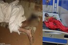 पोलिसांनी दाखवली माणुसकी, पायाला गोळी लागलेल्या माओवाद्याला रुग्णालयात केले दाखल
