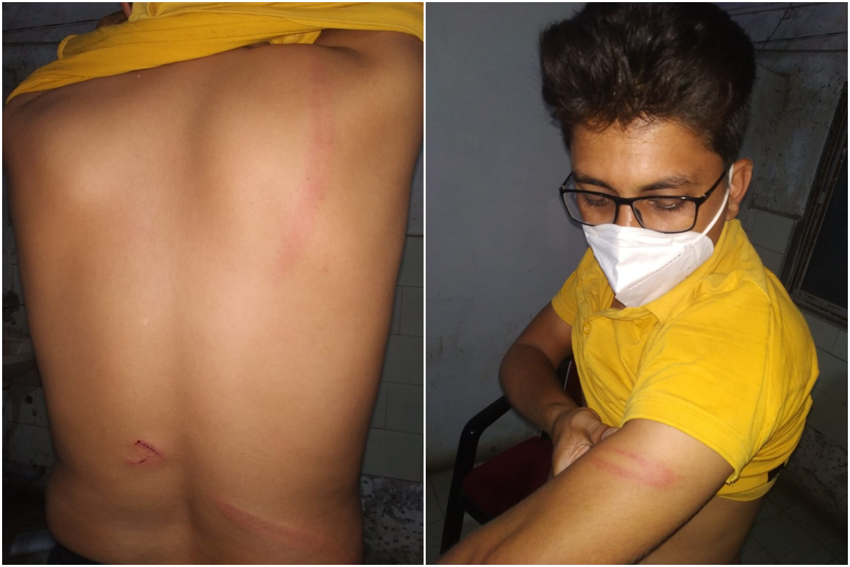 VIDEO: कर्तव्यनिष्ठ डॉक्टरलाच पोलिसांकडून अमानुष मारहाण झाल्याचा दावा, निषेधार्थ डॉक्टरांचे कामबंद आंदोलन