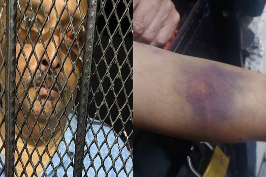 मेहुल चोक्सीला भारतात आणण्यासाठी जोरदार प्रयत्न सुरु