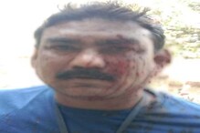 सांगलीत मनपा कर्मचाऱ्यावर भटक्या कुत्र्यांचा हल्ला, संपूर्ण शरीराचे तोडले लचके सांगलीत मनपा कर्मचाऱ्यावर भटक्या कुत्र्यांचा हल्ला, संपूर्ण शरीराचे तोडले लचके