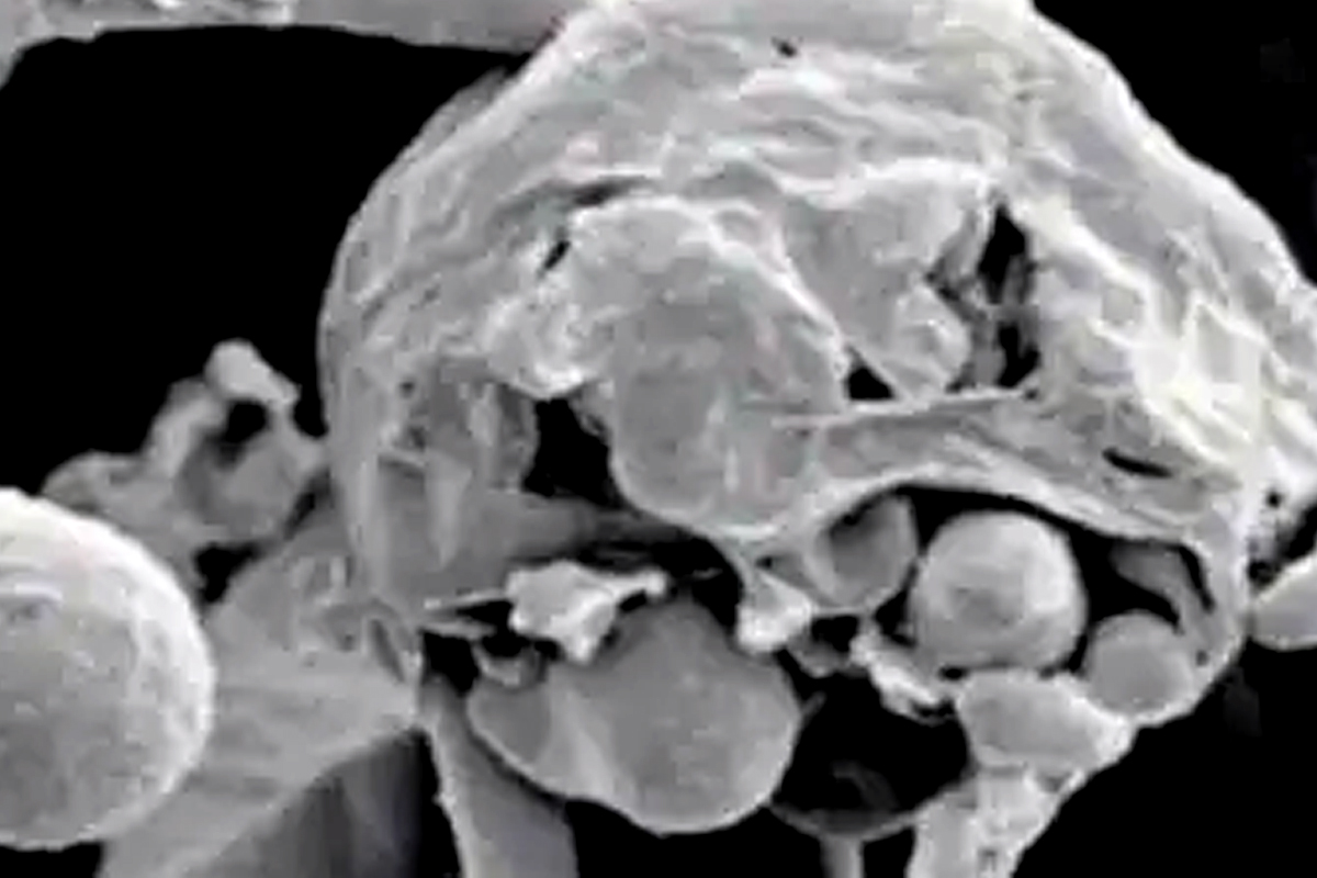 ब्लॅक फंगसपेक्षा White Fungus आहे अतिधोकादायक; जाणून घ्या कसा करावा बचाव