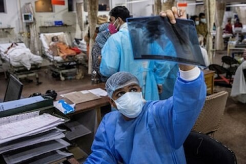8 वर्षांच्या कोरोना संक्रमित मुलाचं फुफ्फुस, किडनी आणि लिव्हरही संक्रमित झालं.