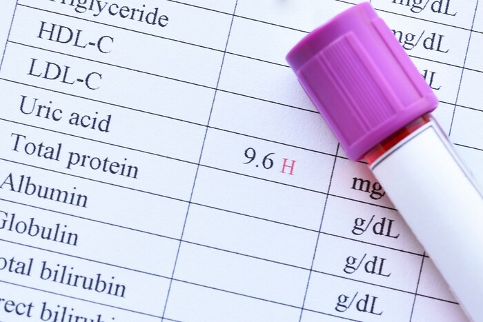 युरिक ऍसिड नियंत्रणात येण्यासाठी मेटाबॉलिजम(Metabolism) चांगलं असणं आवश्यक असतं. कच्चा कांदा मेटाबॉलिजम बुस्ट करण्याचं काम करतं. 