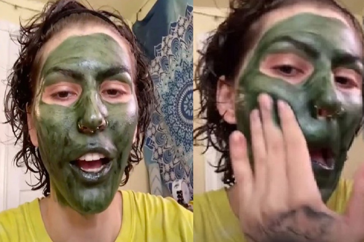 पिंपल्सवर उपाय म्हणून महिला टूथपेस्ट चेहऱ्याला लावतात.