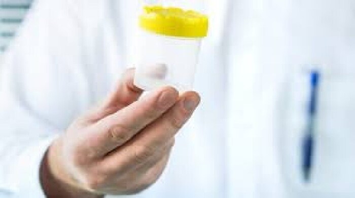 पुरुषांच्या वीर्याच्या परिक्षणावरून त्यांच्यातील Infertility च्या समस्येची माहिती मिळते. शुक्राणूंची संख्या आणि हालचाल यावरून त्याचं मूल्यांकन केलं जातं.