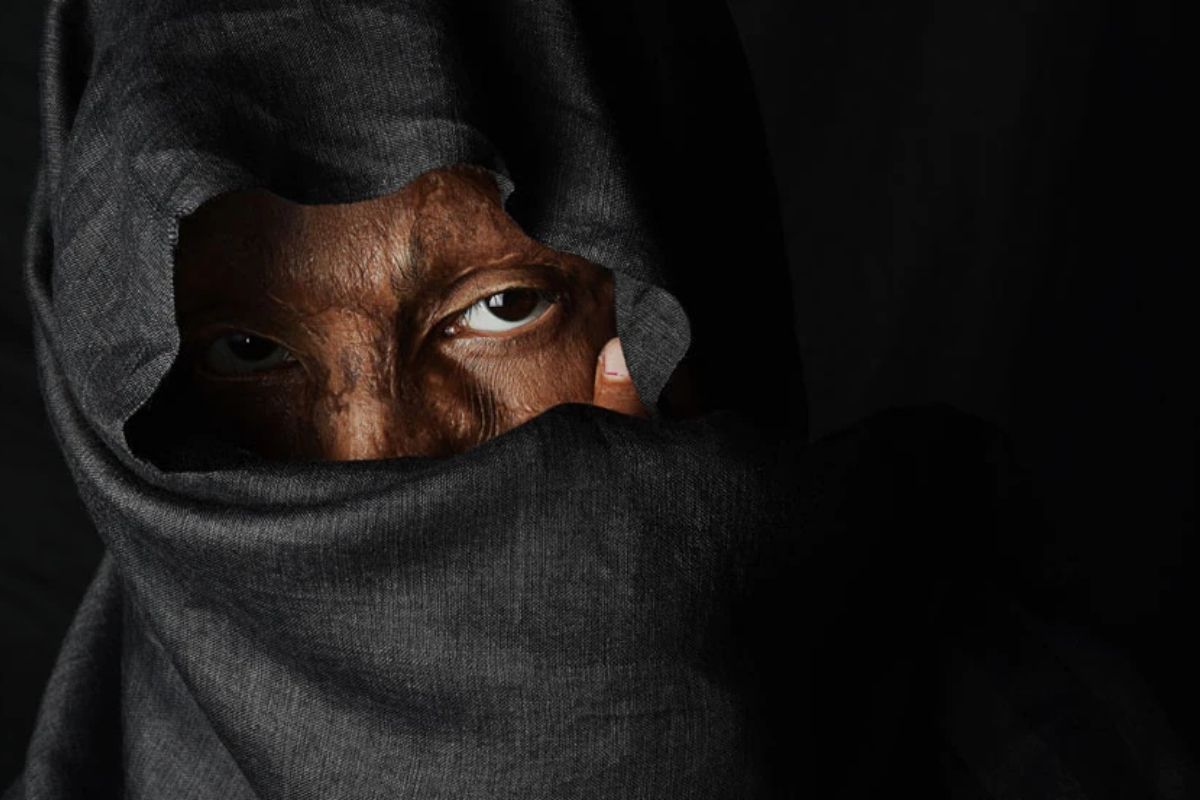 मुंबईत दिरानंच विधवा वहिनीच्या चेहऱ्यावर फेकलं अॅसिड, धक्कादायक कारण आलं समोर