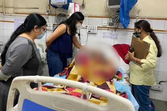 लग्नाच्या 3 महिन्यानंतर पतीचं खरं रुप समोर, कारसाठी पैसे न आणल्यानं पाजलं अ‍ॅसिड