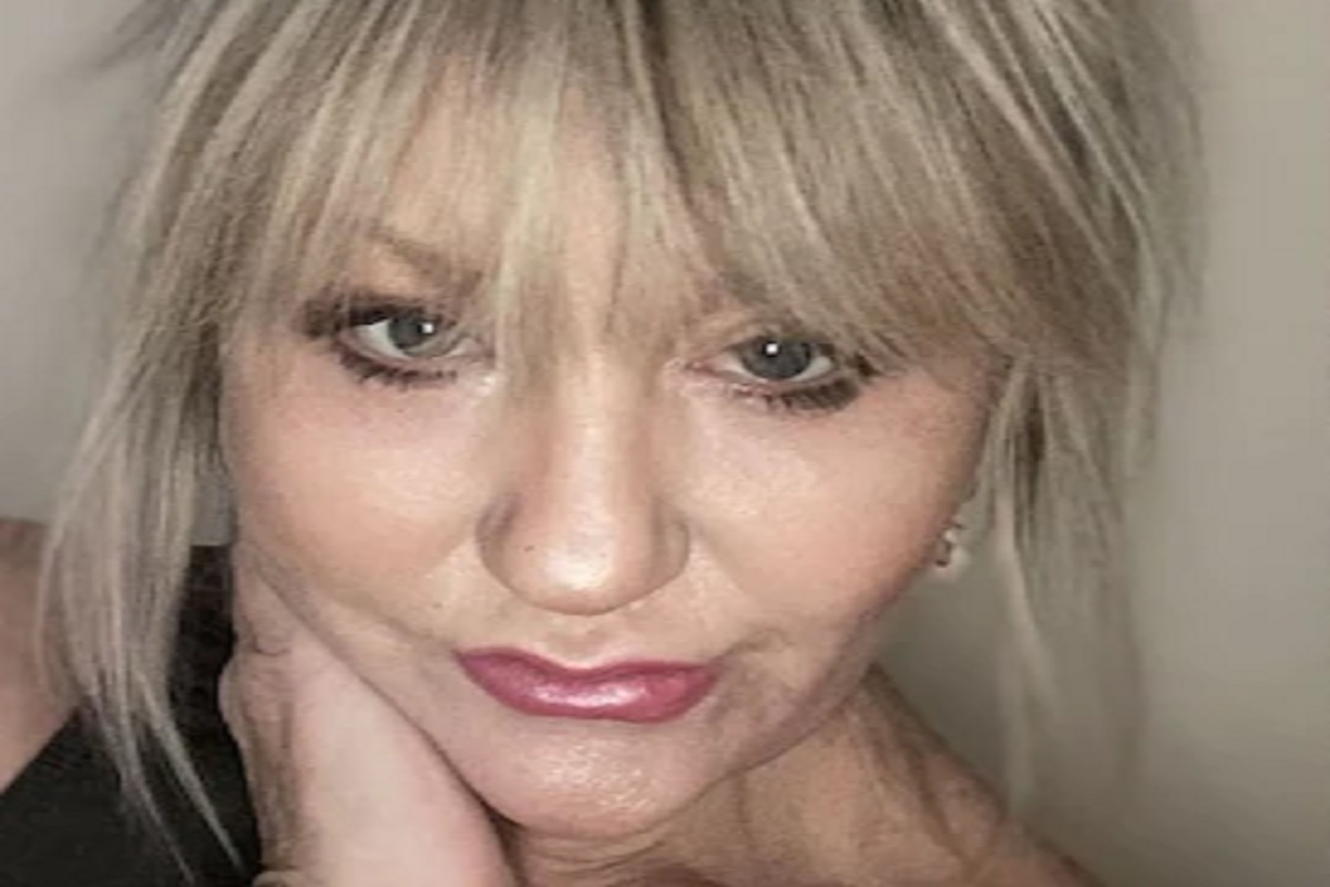 तरुण नाहीच पण भयानक दिसू लागली; 2 लाख रुपयांची क्रीम लावल्यानंतर महिलेच्या चेहऱ्याची भयंकर अवस्था