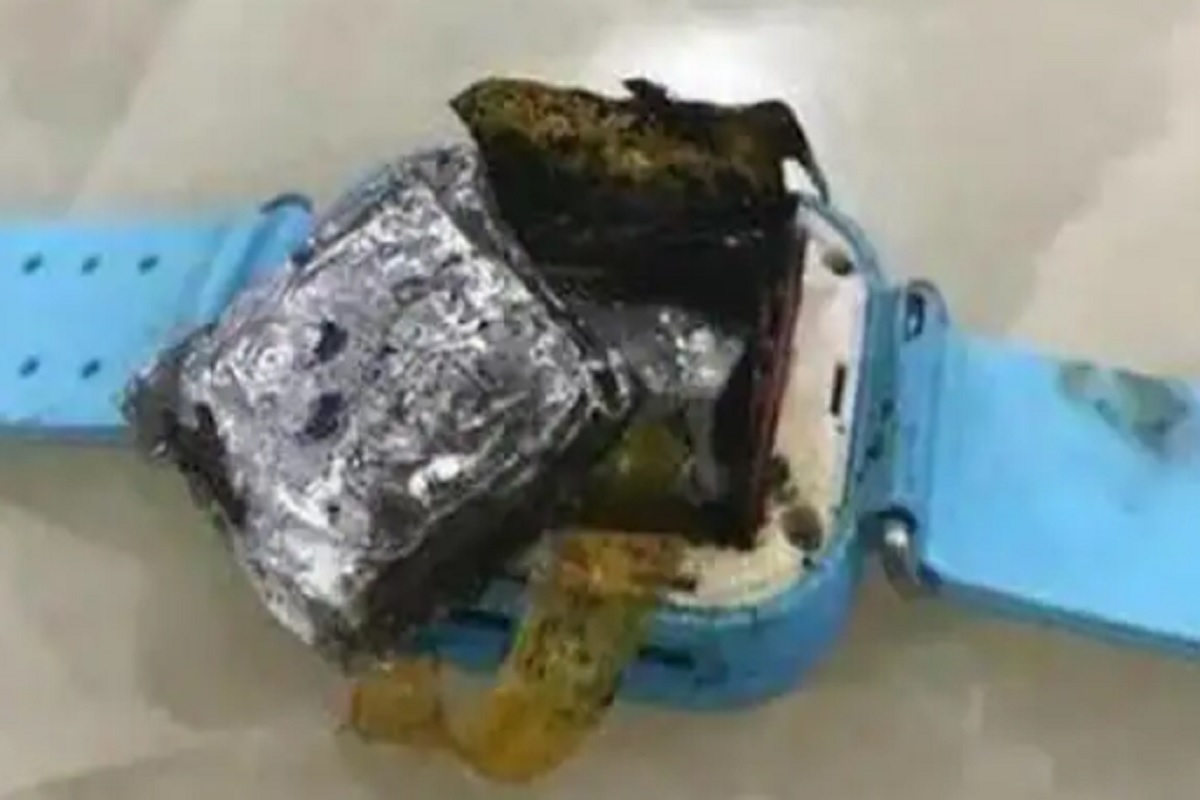 भयंकर! Smartwatch मध्ये अचानक स्फोट; 4 वर्षांच्या चिमुकलीचं मनगट जळालं, थोडक्यात वाचला जीव