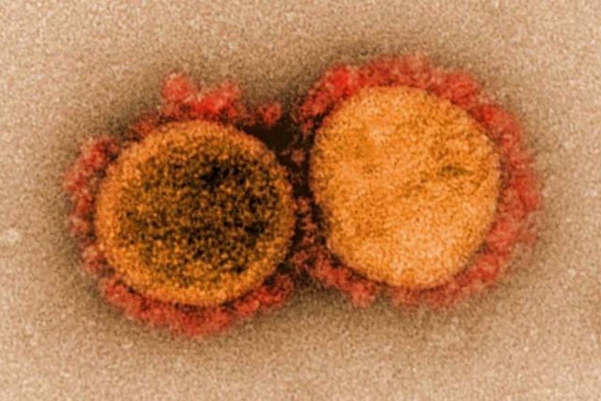 चिंताजनक! कांजण्याप्रमाणेच पसरतोय डेल्टाचा संसर्ग, लसीकरण झालेल्या लोकांनाही धोका?