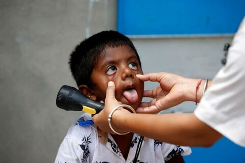 गेल्या दहा दिवसांत बहुतेक लहान मुलांना सर्दी, खोकला आणि ताप आला आहे. 