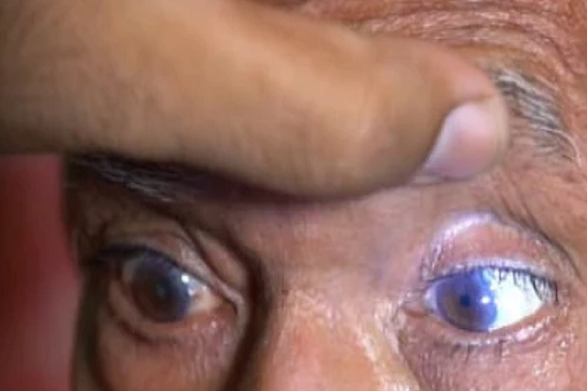 आश्चर्य! कोरोना लस घेतल्यानंतर डोळ्यांची दृष्टी परत आली; 70 वर्षांच्या आजींचा दावा