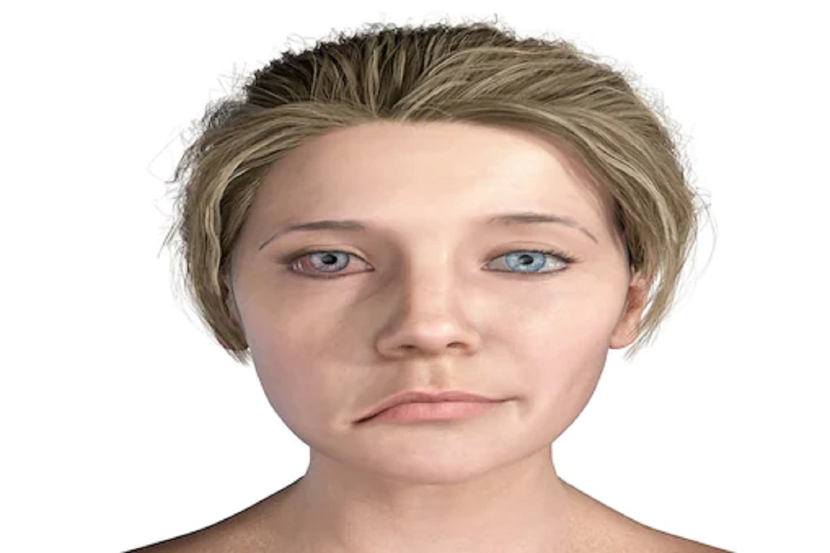 कोरोनानंतर Bell's Palsy चा धोका; चेहऱ्यावर अशी लक्षणं असल्यास दुर्लक्ष करू नका