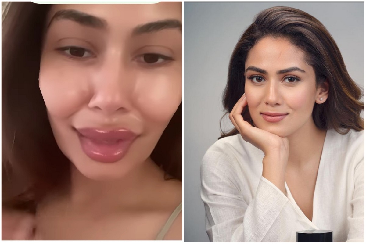 प्लास्टिक सर्जरीमुळे शाहिदच्या पत्नीची झाली ही अवस्था? जाड ओठ, सुजलेला चेहरा पाहून चाहते हैराण