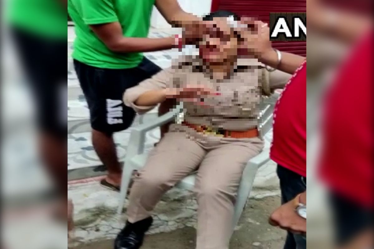 या हल्ल्यात संबंधित महिला पोलिसाचं डोकं फुटल्यानं त्या रक्तबंबाळ झाल्या आहेत.