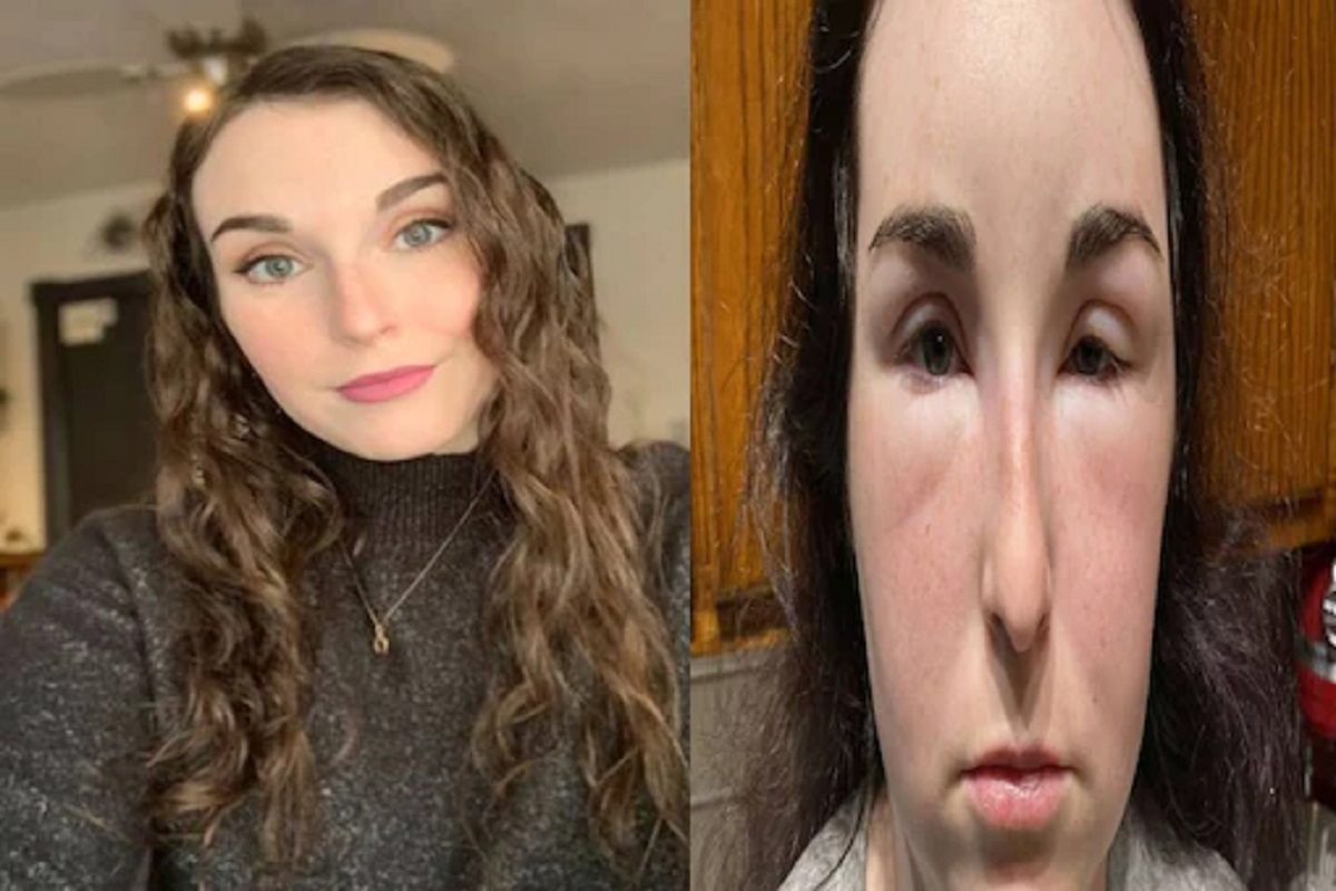 फोटो सौजन्य - Kennedy News and Media