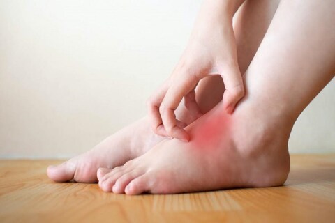 किडनी संदर्भात काही त्रास असतील तर, पायावर सूज येण्याची शक्यता असते. 