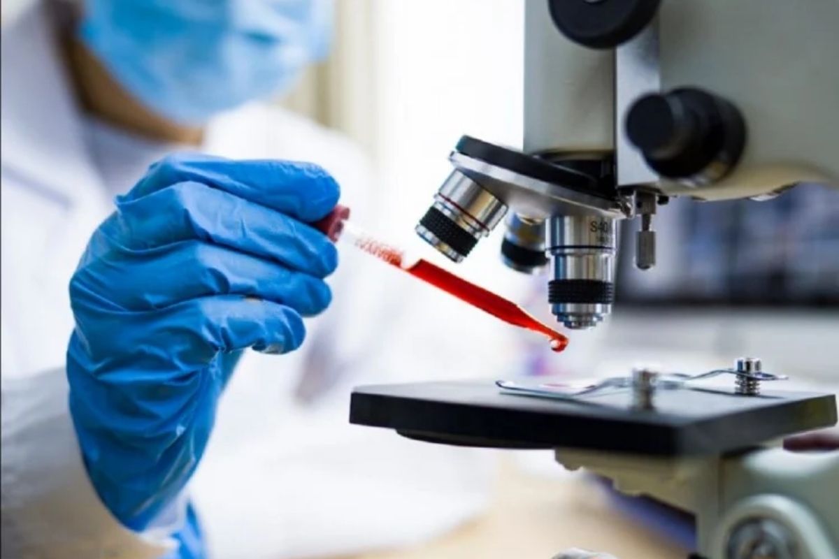 तर, 2013 मध्ये झालेल्या रिसर्चनुसार कर्क्युमिनमध्ये फ्लेक्सोफिटॉल नावाचा घटक असतो. ज्यामुळे वेदना कमी होतात. तज्ज्ञांच्यामते युरिक ऍसिडवर नियंत्रण मिळवण्यासाठी हळदीचा वापर करता येतो.