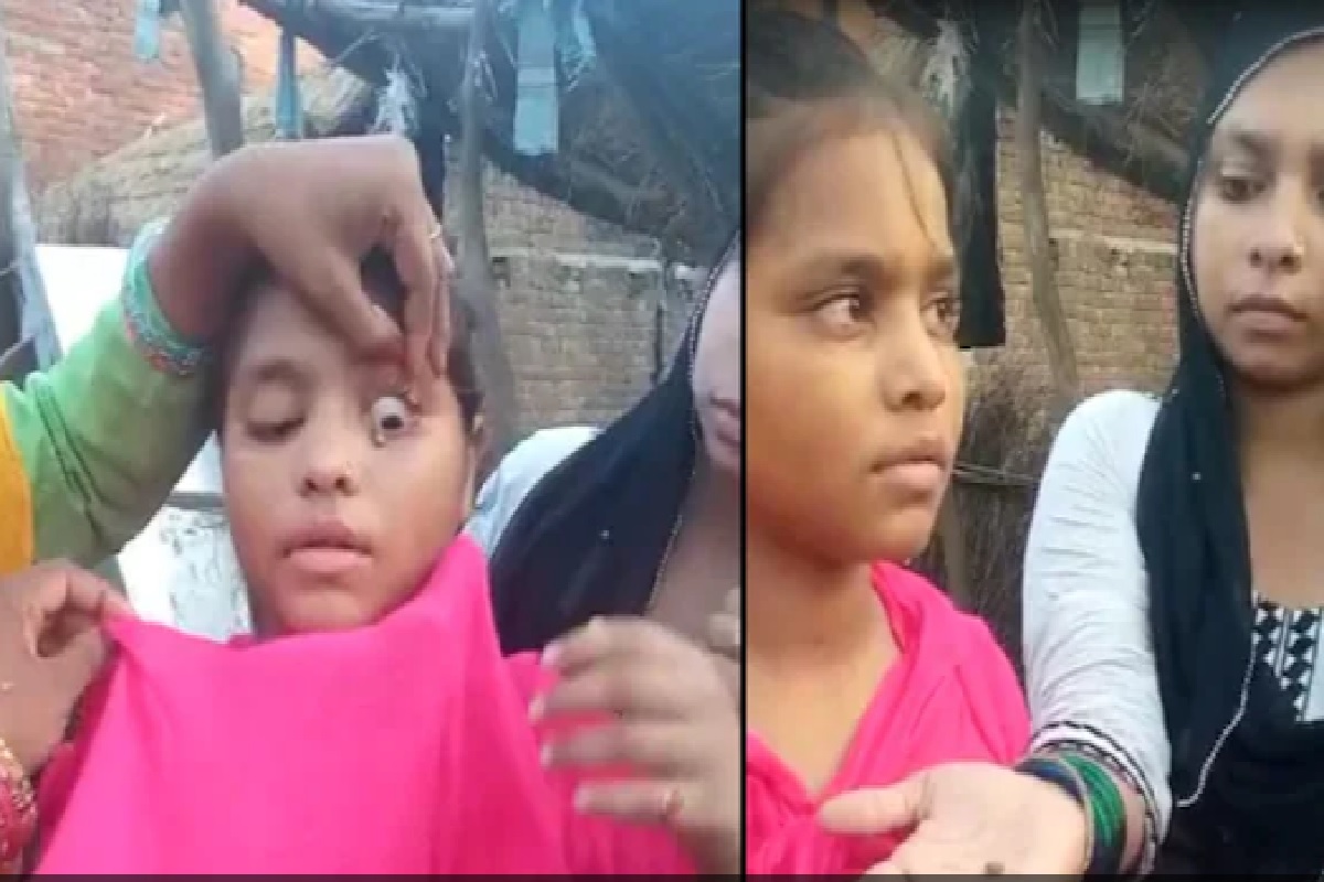 OMG! या मुलीच्या डोळ्यांतून आसवांसोबत टपकतात खडे, डॉक्टरही हैराण; पाहा VIDEO