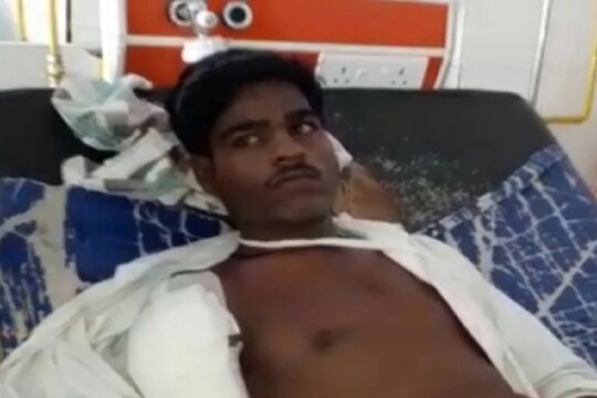 बापरे! लस घेताना तुटली सुई, तरुणाचा हात आणि पाय झाला जायबंदी