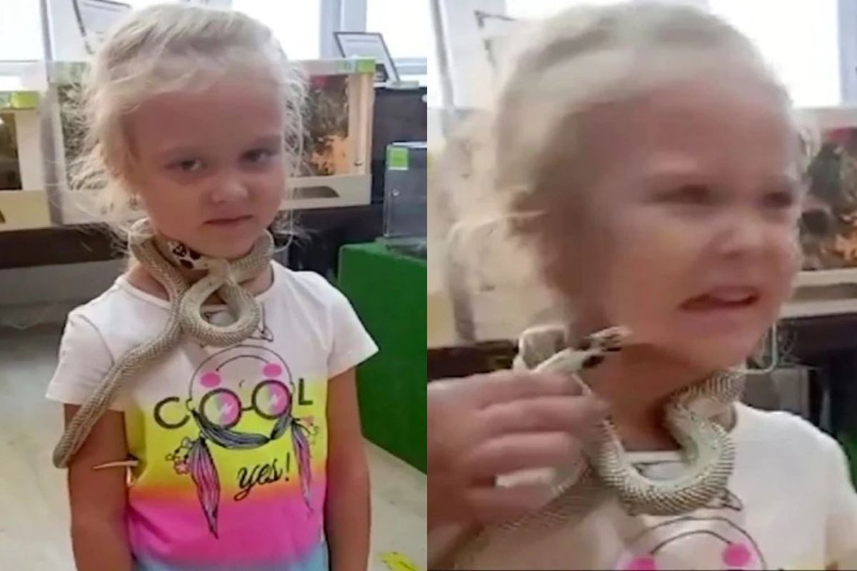 चिकन खाऊन प्राणीसंग्रहालयात जाणं पडलं महागात; सापानं चिमुकलीच्या गालाची केली वाईट अवस्था