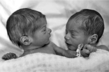 जोर का झटका! जुळ्या मुलांचे वेगवेगळे बाप; डीएनए रिपोर्ट पाहून डॉक्टरही हैराण