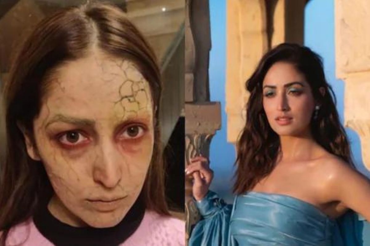 बापरे! यामी गौतमच्या चेहऱ्याची झाली अशी अवस्था! पाहून तुम्हालाही भरेल धडकी