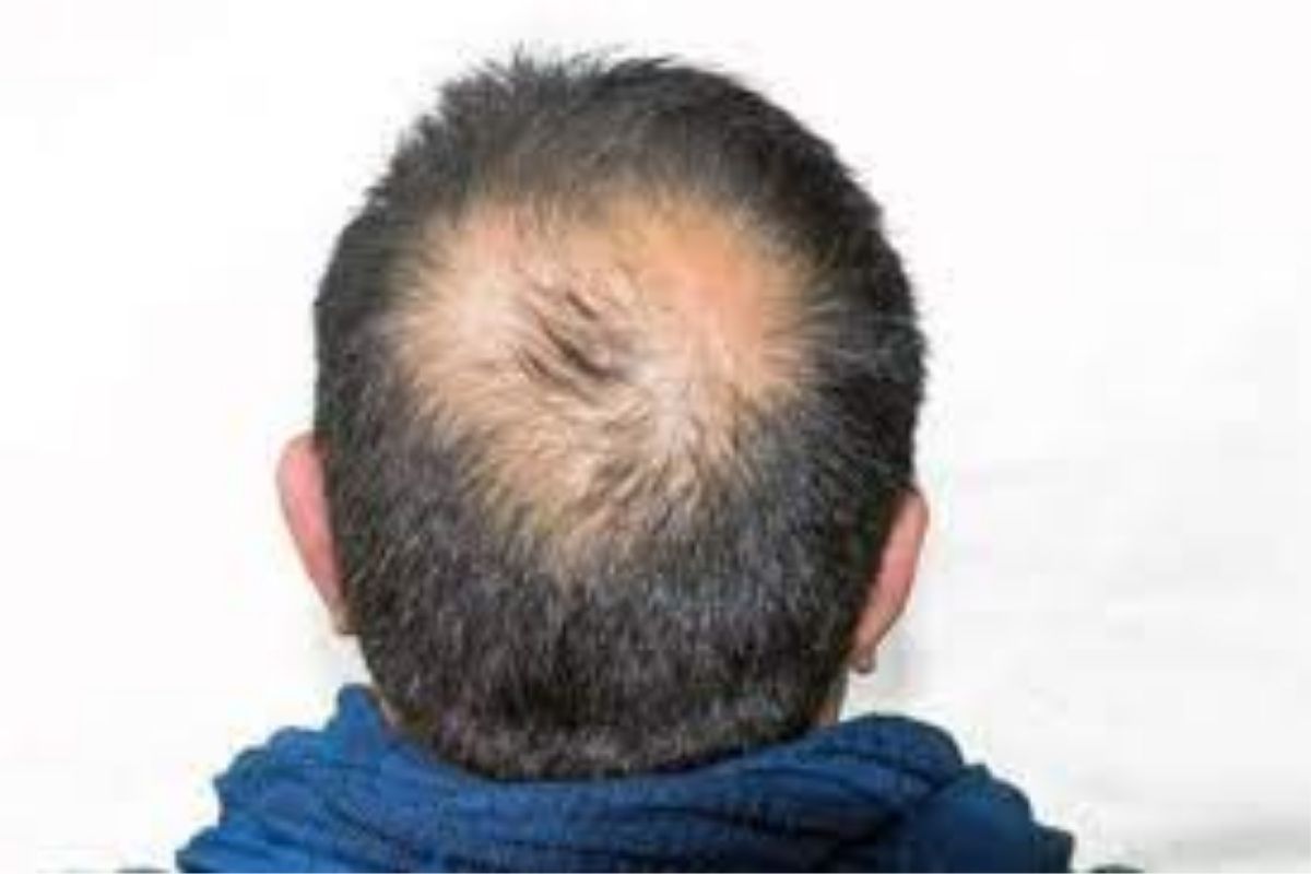 Yoga for hair: दररोज पाच मिनिटे 'हा' योग केल्याने थांबू शकतं केस गळणं