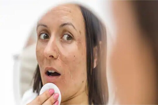 Makeup And Sleep : तुम्हीही रात्री मेकअप न काढताच झोपता? त्वचेवर होतील हे गंभीर परिणाम