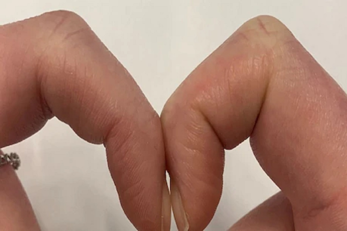 तुमची बोटंच सांगतील तुम्हाला कॅन्सर आहे की नाही; घरबसल्या करा ही सोपी Finger test