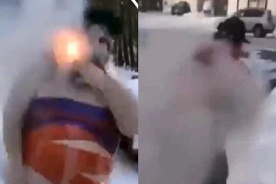तोऱ्यात छातीला फटाक्यांची माळ गुंडाळून पेटवली आणि...; 'खतरों की खिलाडी' बनण्याची हौस पडली भारी