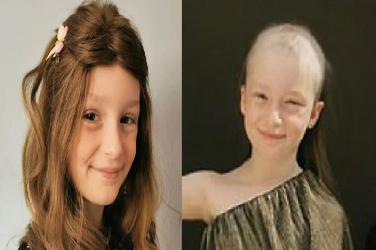 बापरे! चिमुकलीच्या पापण्या, डोक्यावरील केस गायब; Corona lockdown चा झाला भयंकर दुष्परिणाम