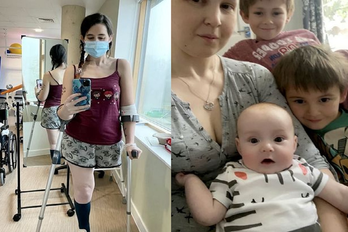 पोटच्या गोळ्यासाठी आईने स्वीकारलं अपंगत्व; स्वतःचा पाय कापून दिला बाळाला जन्म