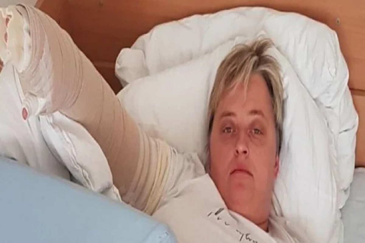 Shocking! छातीचा झाला दगड, फुग्यासारखे फुगू लागले ब्रेस्ट; सर्जरीनंतर महिलेची झाली भयंकर अवस्था