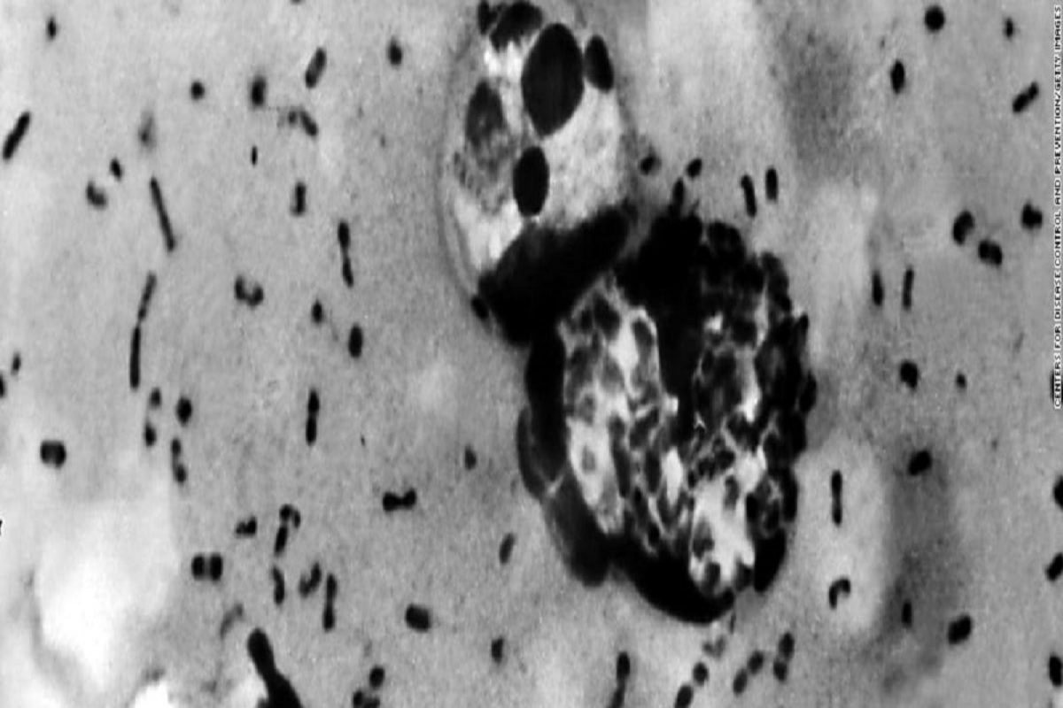 बापरे ! Corona नंतर आता Black death ची लाट येणार? रशियन डॉक्टरने दिला इशारा (Photo : CNN)