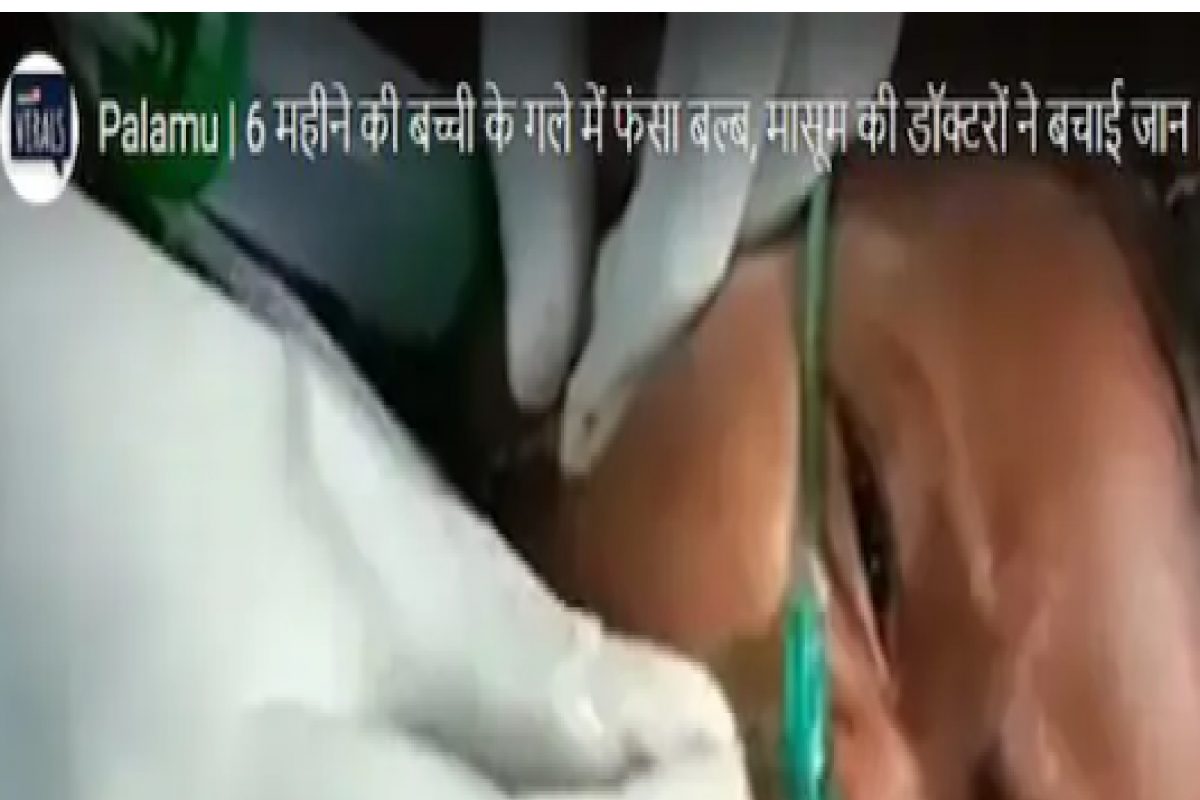 बिचारं! बाळाने गिळला बल्ब, एका निर्णयामुळे वाचला जीव; पाहा VIDEO