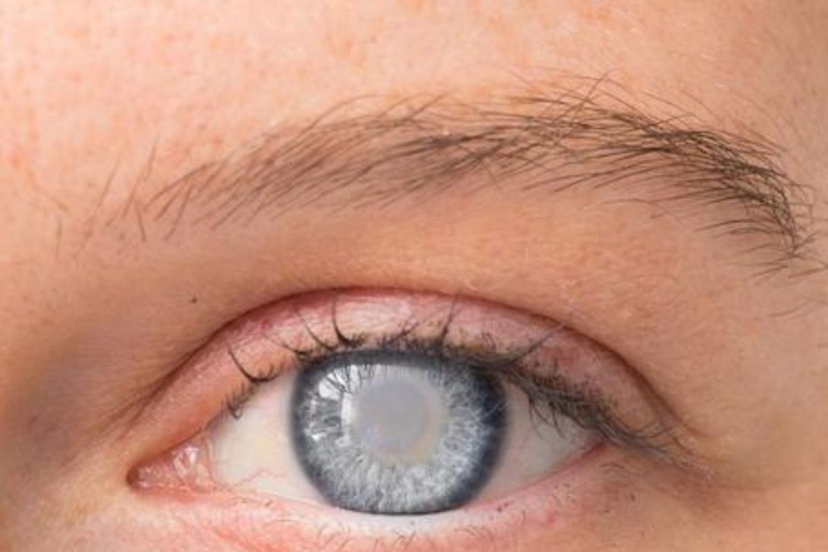 आता व्हायरस अंधत्व दूर करणार, शास्त्रज्ञांनी शोधून काढलं नवीन Technic !