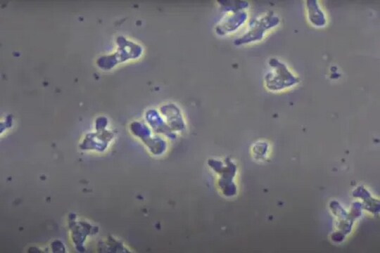 Shocking! डोक्यात घुसून कुरतडून कुरतडून खाल्ला संपूर्ण मेंदू; Brain Eating Amoeba ने घेतला चिमुकल्याचा जीव