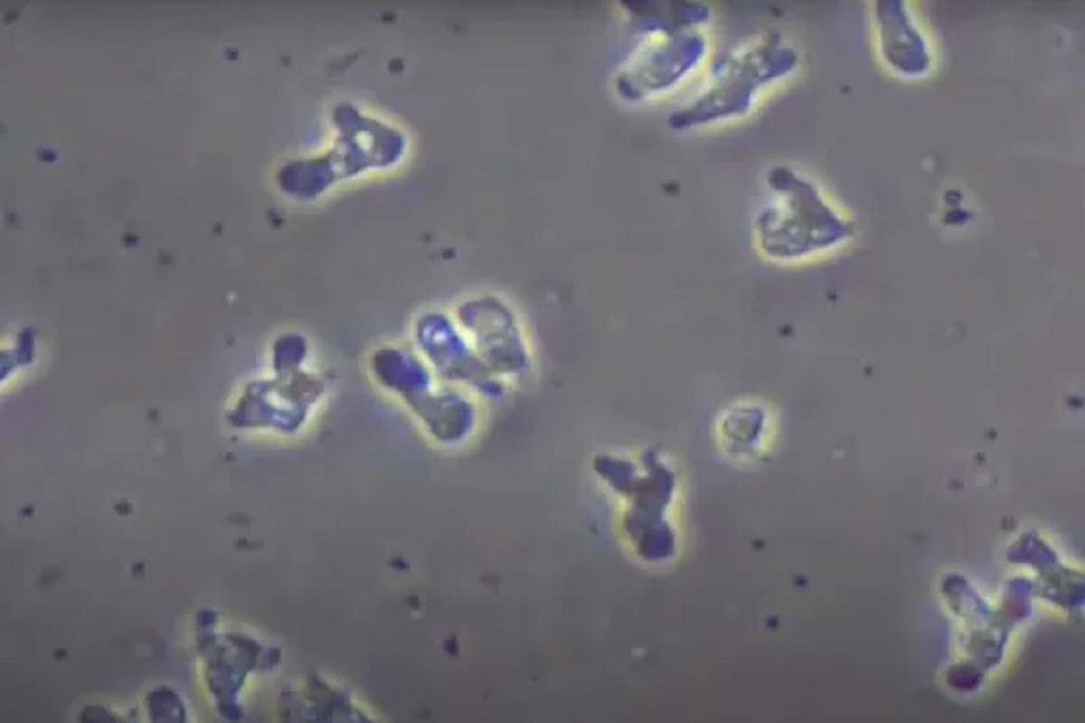 Shocking! डोक्यात घुसून कुरतडून कुरतडून खाल्ला संपूर्ण मेंदू; Brain Eating Amoeba ने घेतला चिमुकल्याचा जीव