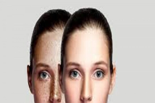 दिवाळीआधी लावा हा खास Curd Face mask; डाग-सुरकुत्या होतील गायब, चेहराही उजळेल