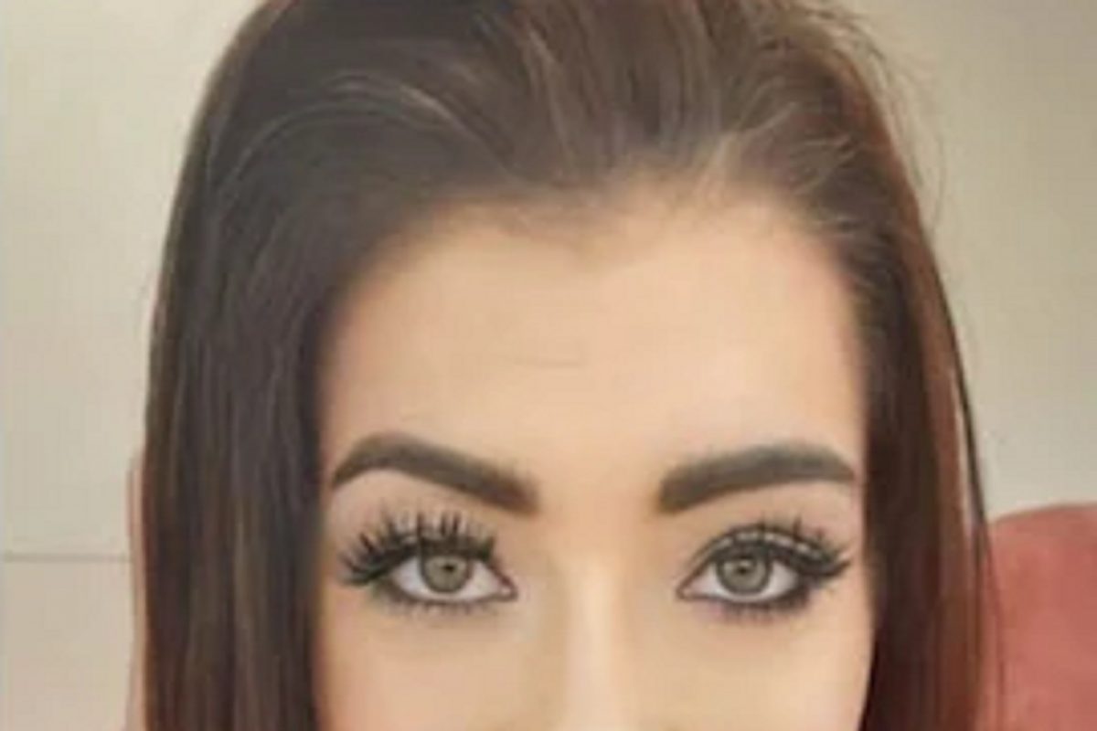 सुंदर दिसण्यासाठी लावले Fake eyelashes आणि महिलेचे डोळे...; भयंकर Photo पाहून तुम्हीही हादराल