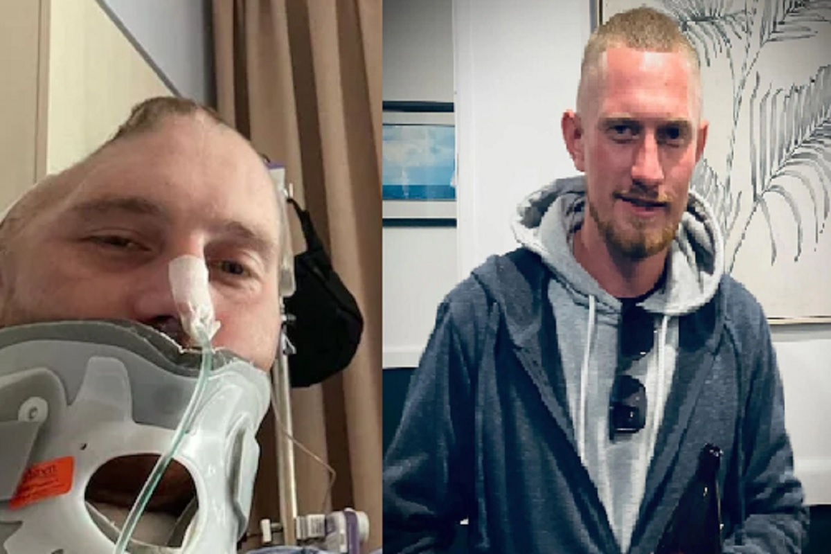 Shocking! हाणामारीत भयंकर फुटलं डोकं; तरुणाची निम्मी कवटी गायब