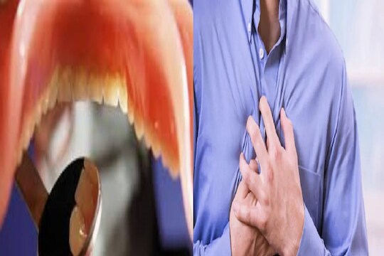 तुम्हाला Heart attack येण्याची किती शक्यता? तोंडातून मिळतेय धोक्याची घंटा