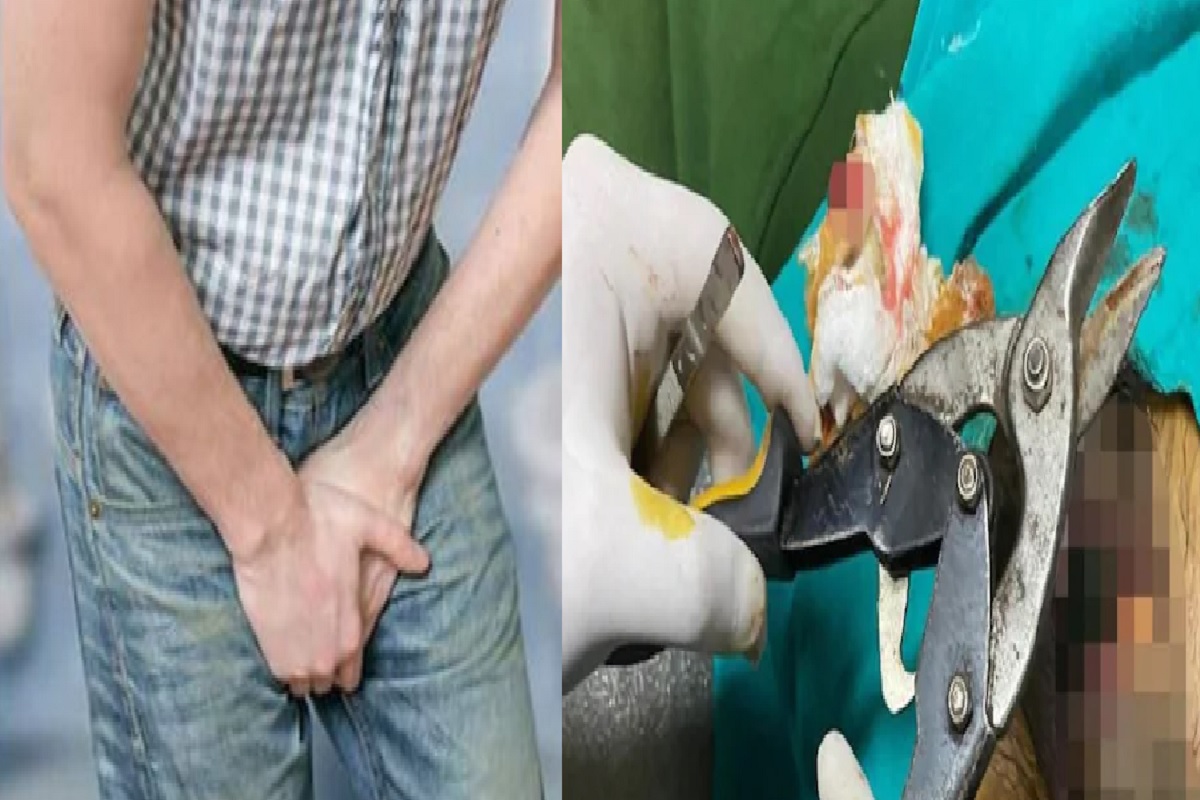 बापरे! 2 महिने बाटलीत अडकला त्याचा Private part; अवस्था पाहून डॉक्टरांनी कापूनच टाकला