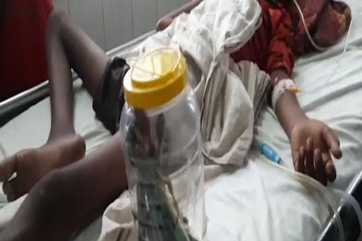 बापरे! 14 वर्षांच्या मुलाने खाल्ले तब्बल 16 Toothbrush; एक वाईट सवय सोडवण्यासाठी केला भयंकर उपाय!